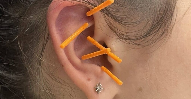 April 1st FREE Ear Acupuncture