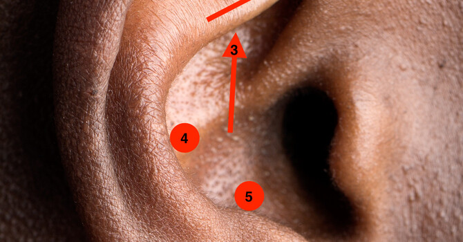 Donation Ear Acupuncture - July
